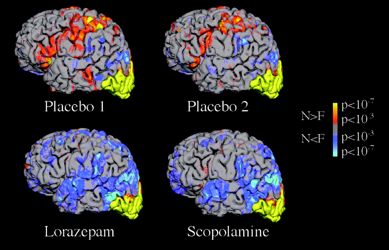 Effect of scopolamine and lorazepam on memory using fMRI